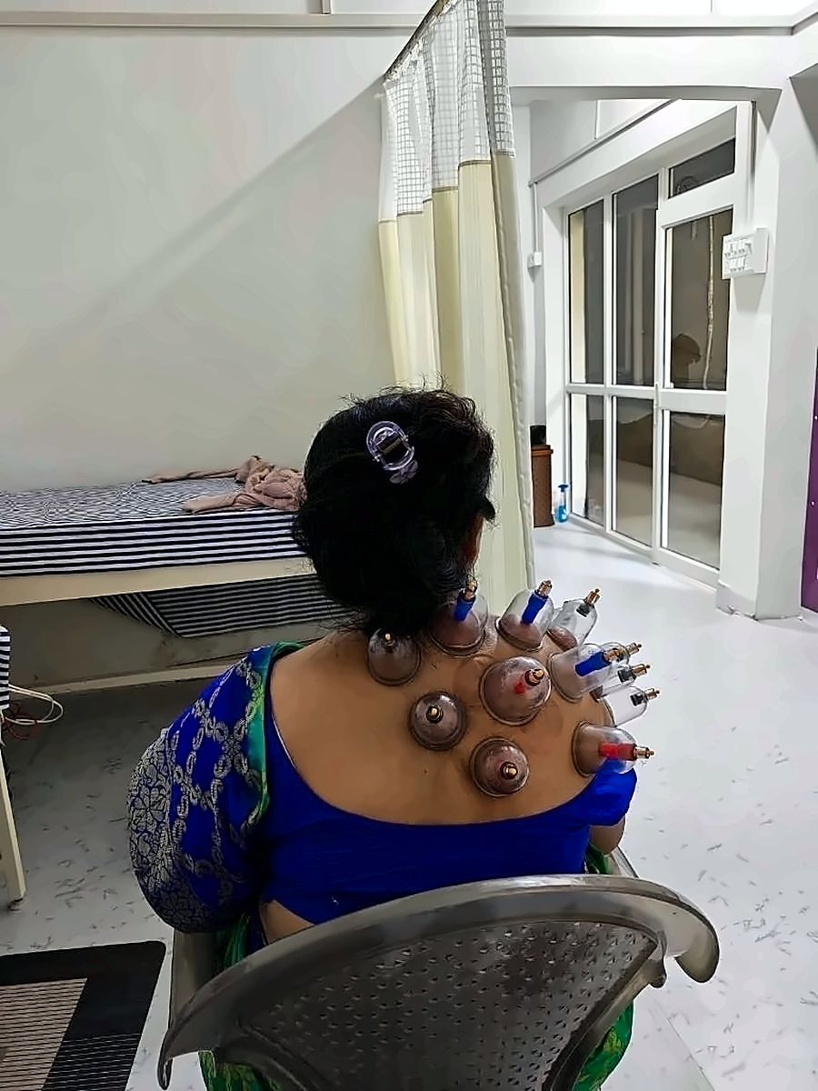 Cupping therapy on neck and shoulder of a patient at MuvAgain physiotherapy clinic