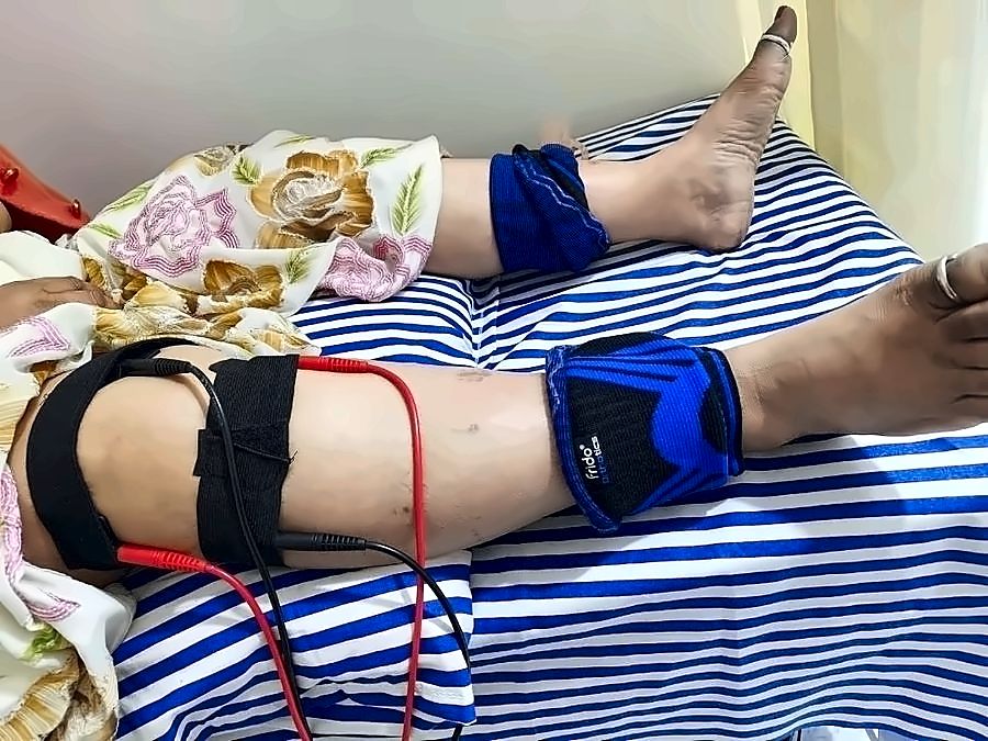 Knee pain electrotherapy with ankle weights for quadriceps strengthening